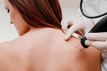 Top Social Media Strategy for Reach More Dermatology Patients